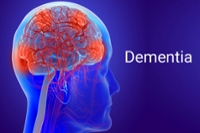 New Findings Around Dementia